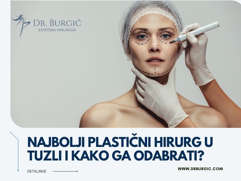 najbolji plastični hirurg u tuzli i kako ga odabarati?